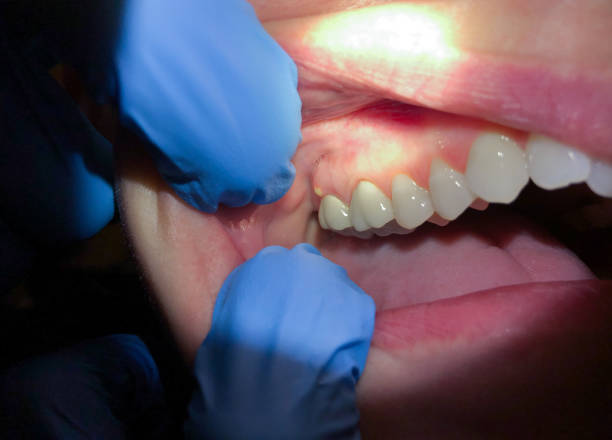 Best Emergency Care for Gum Disease in Pikeville, TN